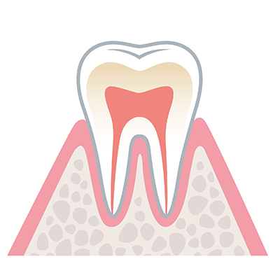periodontal_00