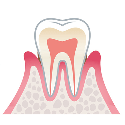 periodontal_01